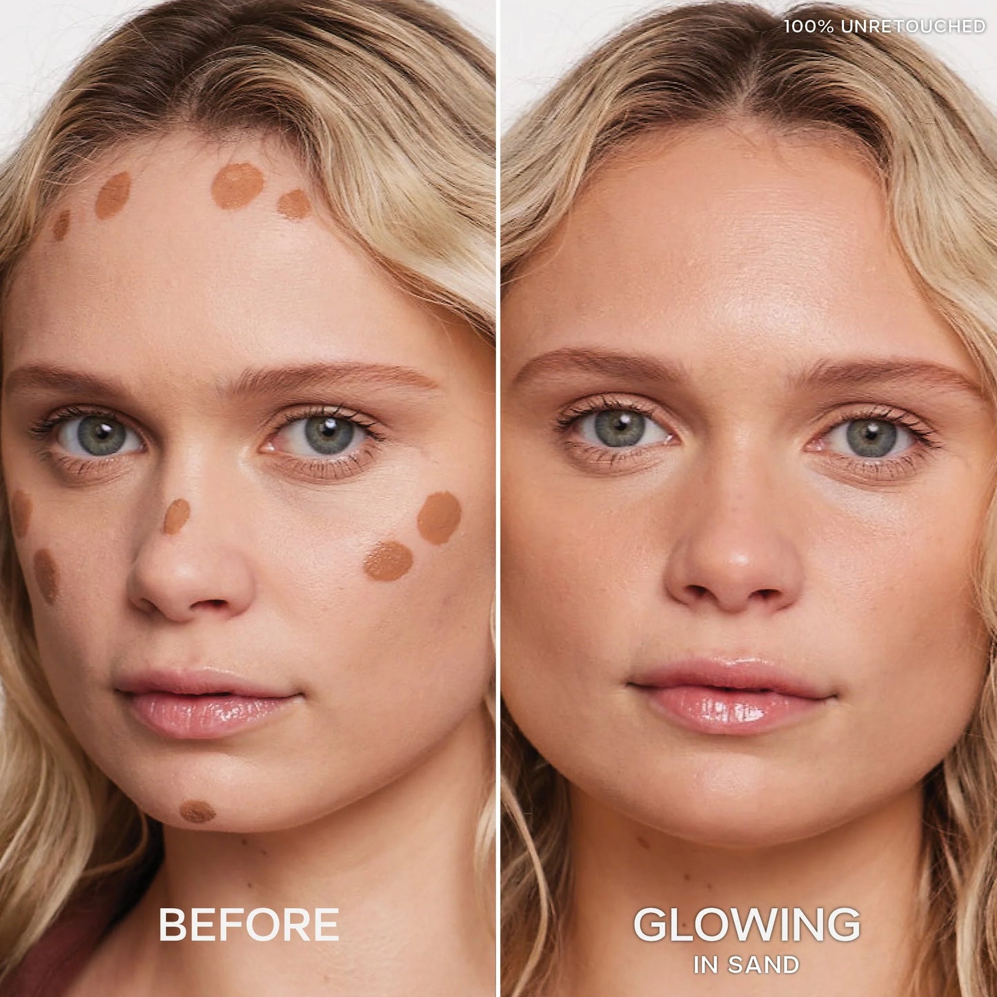 Dew Bronze™ Duo